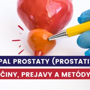 zápal prostaty, prostatitída